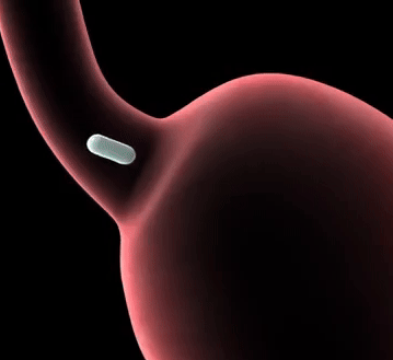 Gélules premium à libération optimisée